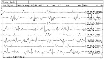 Clinical findings and outcome in feline tetanus: a multicentric retrospective study of 27 cases and review of the literature